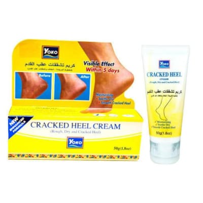 Yoko Cracked Heel Cream 50gm (100% Authentic) saffronskins 